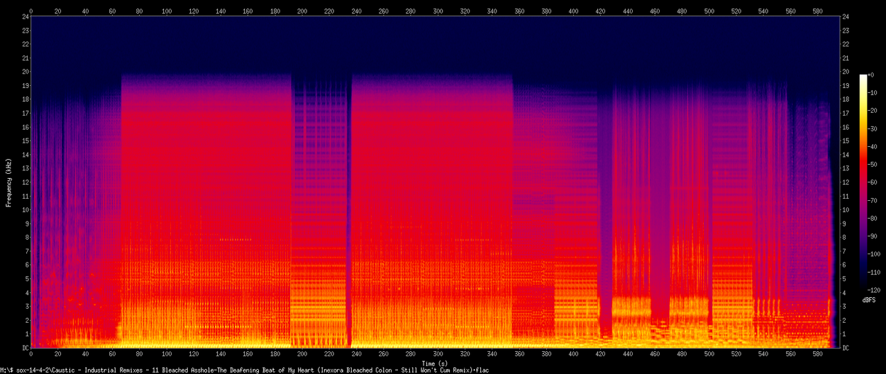 Caustic - Industrial Remixes - 11 Bleached Asshole-The Deafening Beat of My Heart (Inexora Bleached 