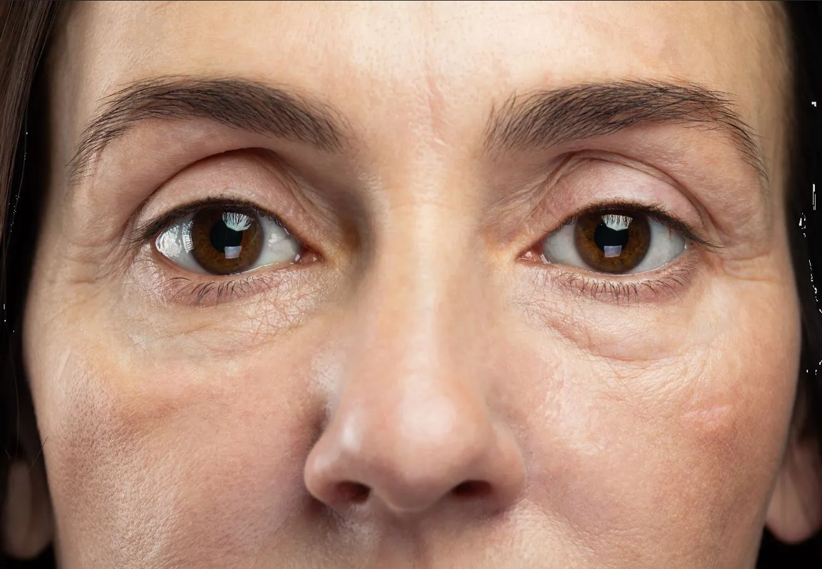 ¿Cómo eliminar las bolsas de los ojos? Esta es la vitamina que debes incluir