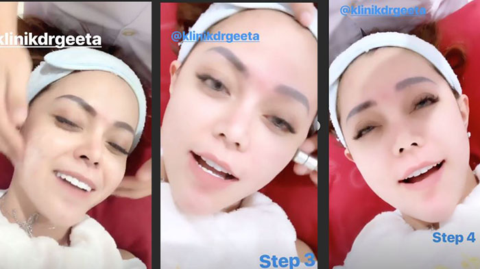Avriella Shaqqila jalani perawatan kulit wajah