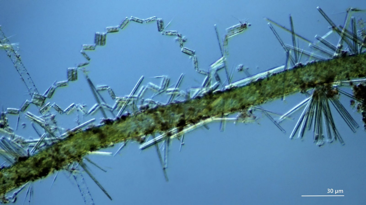 05 Algen Aufwuchs Vaucheria (Schlauchalge) mit Kieselalgen10 M3-20