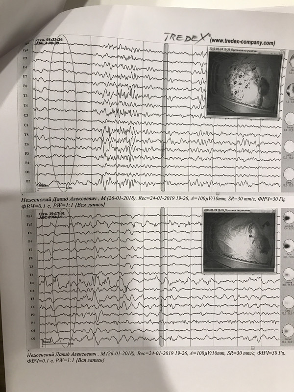 D2562D8D-99B2-4875-A223-38D3138B4D71