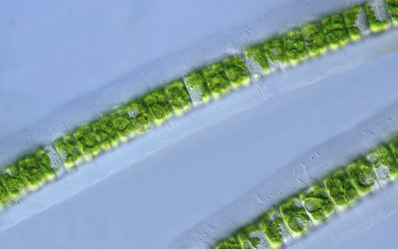 Hyalotheca 05 dissilens Glashüllen-Alge Apikale Porenringe Giglachsee  DIK 100 Komp 2