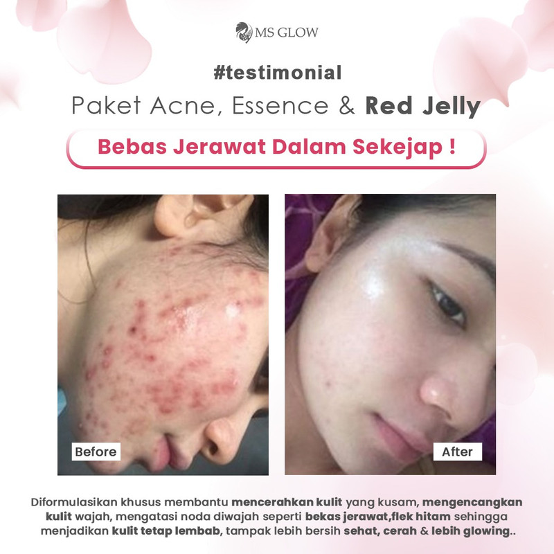 testimoni ms glow skin care