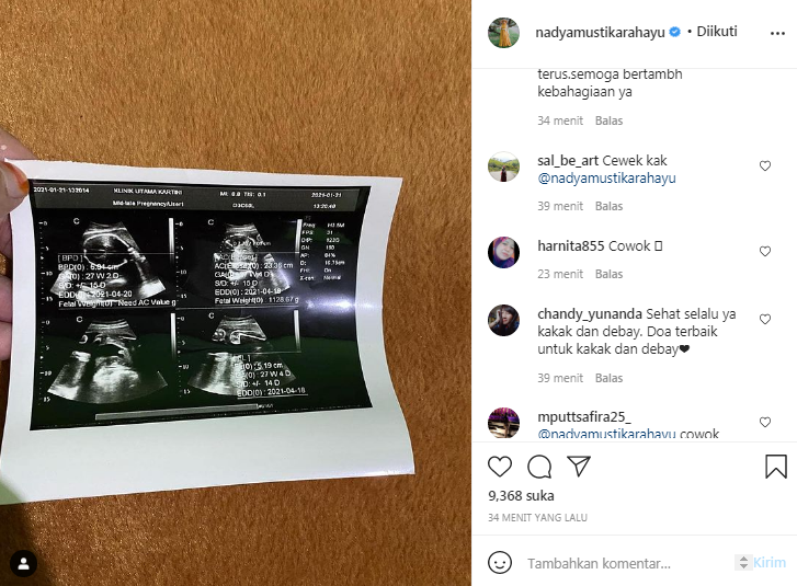 Nadya Mustika unggah foto hasil USG calon bayinya