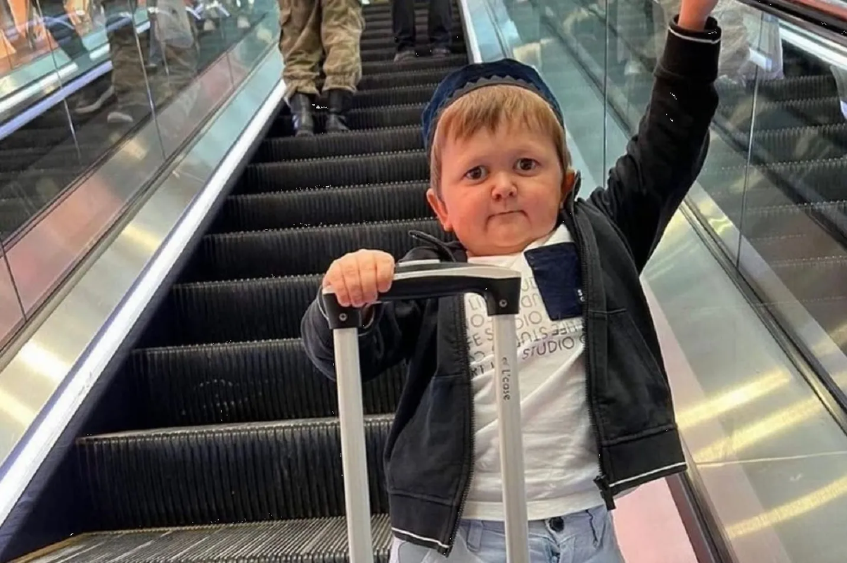 ¿Que significa tener Acondroplasia? Hasbulla es el caso más impactante del mundo