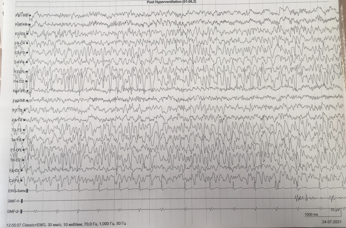 2AC42B5D-9507-436E-AFF4-8E0BFA97F418