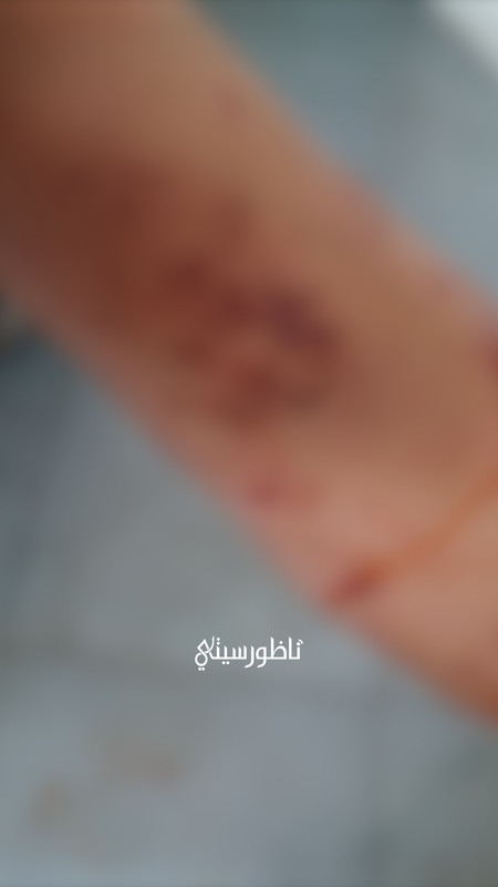 ALALI-L-00-17-49-20-Still020
