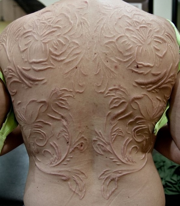 Scarification
