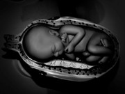 15.4.med school IV(b&w)