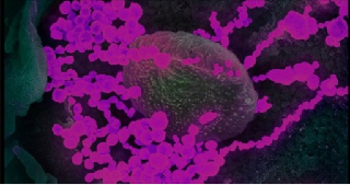 COVID-19 Pathology