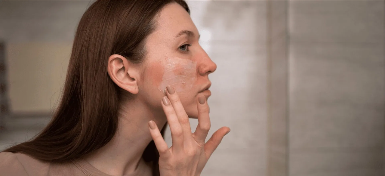 5 ácidos eficaces para eliminar las manchas de acné