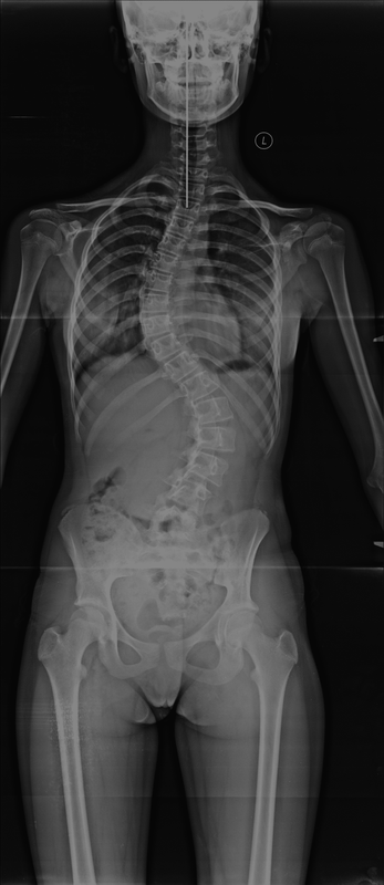 декабрь 2020 без корсета