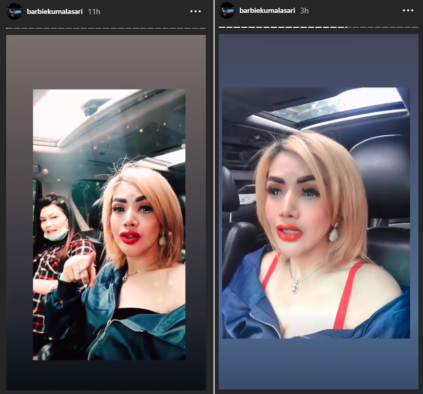 Penampilan baru Barbie Kumalasari setelah sulam bibir