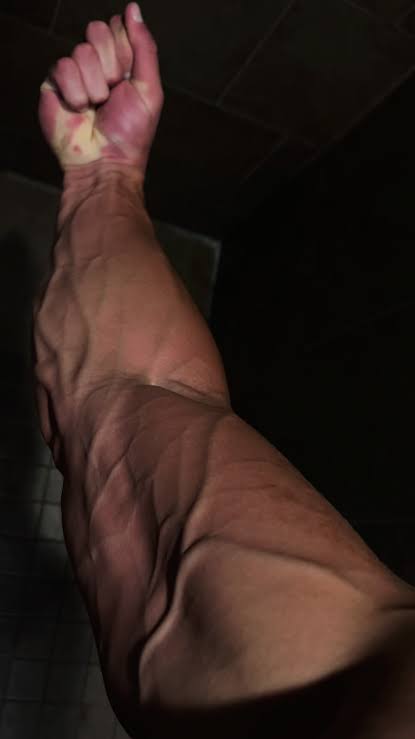 Braço vascularizado durante o treino