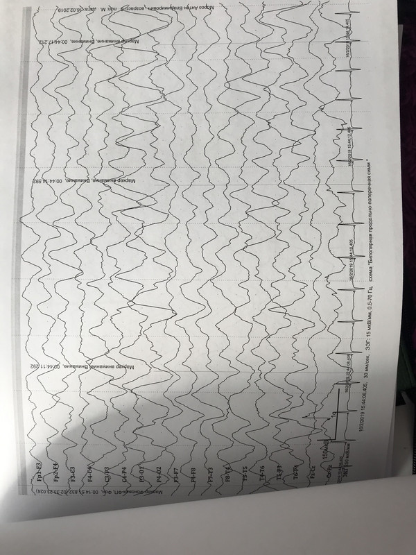 C10D50C2-5295-4E57-9A2A-6BE56269D27C