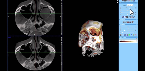 ЦЕНИ | 3D Дентална рентгенова лаборатория Вивиано - Враца