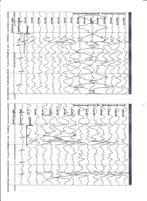 ЭЭг лист3 от 03.17