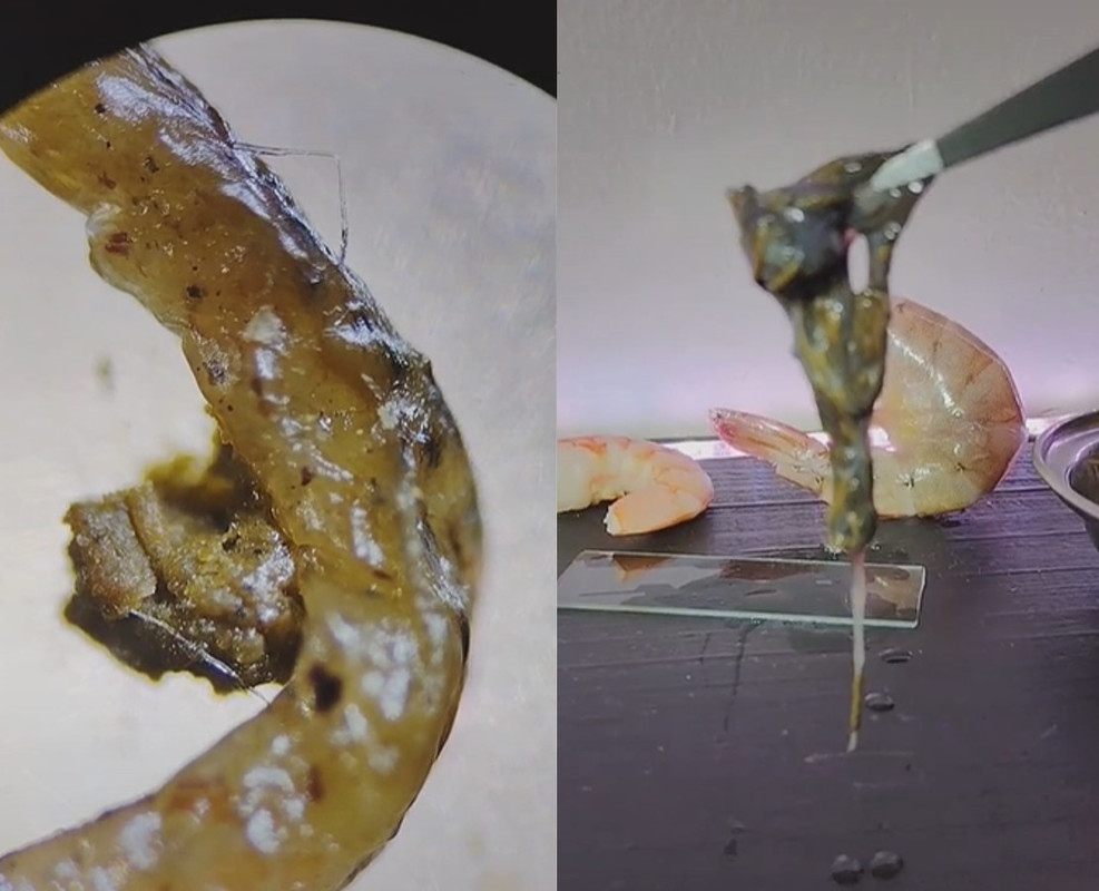 Tiktoker muestra cómo se ve la vena negra del camarón desde un microscopio