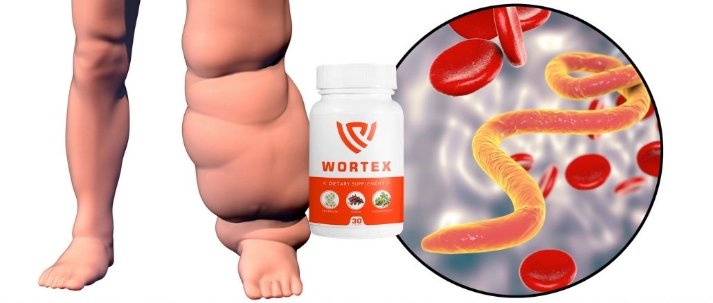 Wortex fontos és érdekes vélemények