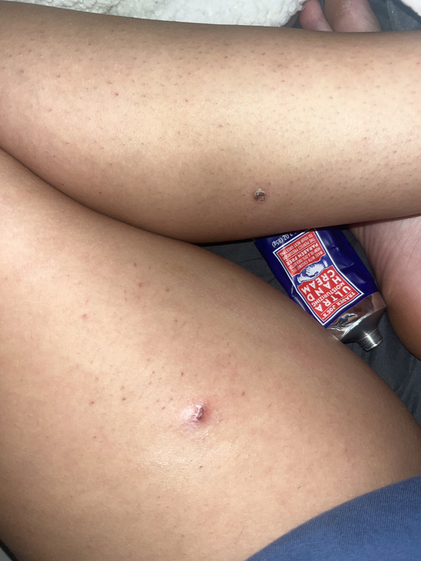 IMG 620ECE4A EE3F 47D5 9FC3 FAF63FA84426