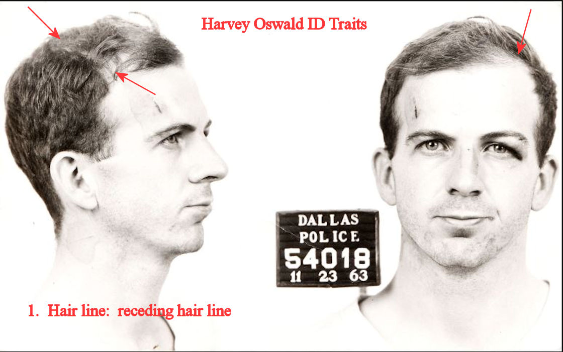 oswald-pic-details-receding-hair-line.jp