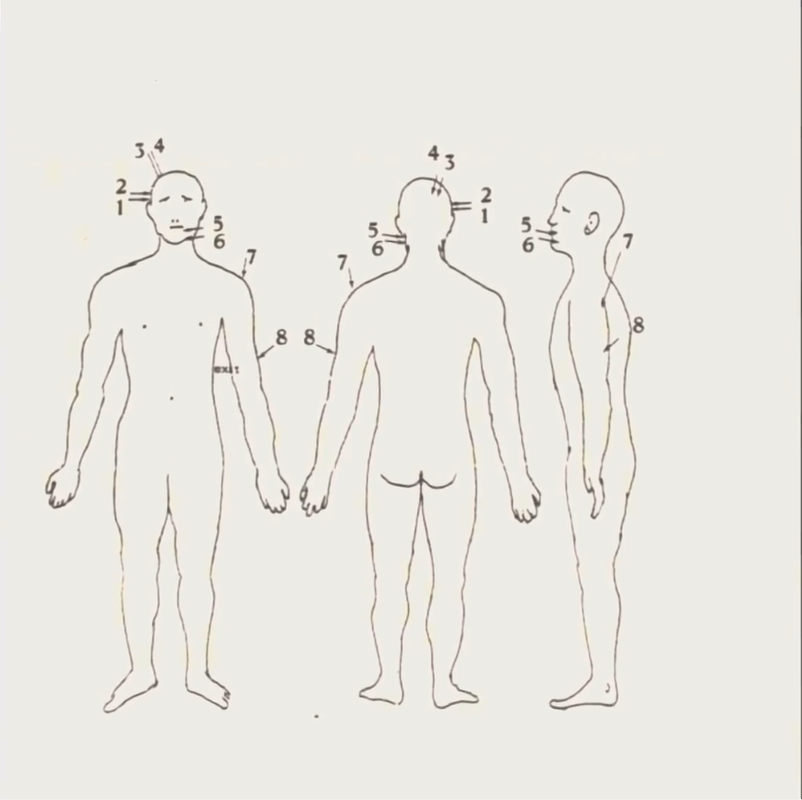 Nevill Bamber's wounds