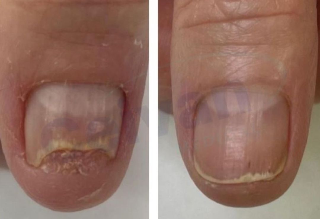 Depoimento cliente Micovax