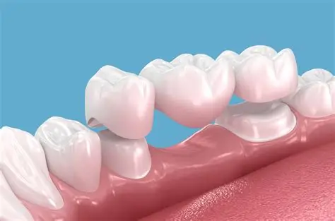 Permanent Dental Crown Restoration