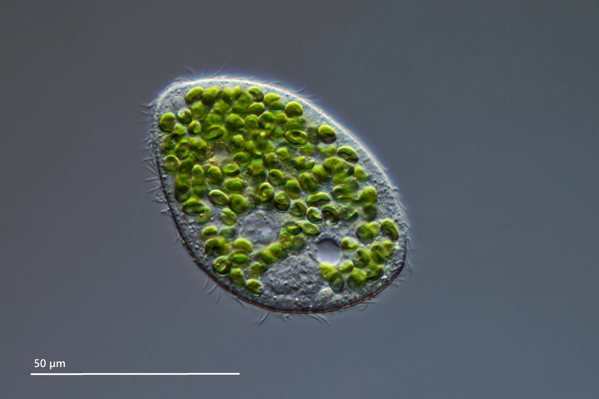 Holophrya 10 (ev) ovum Grüne Zahnwalze Zoochlorellen DIK 100 (Kreutz 175) Bichlersee-Z7