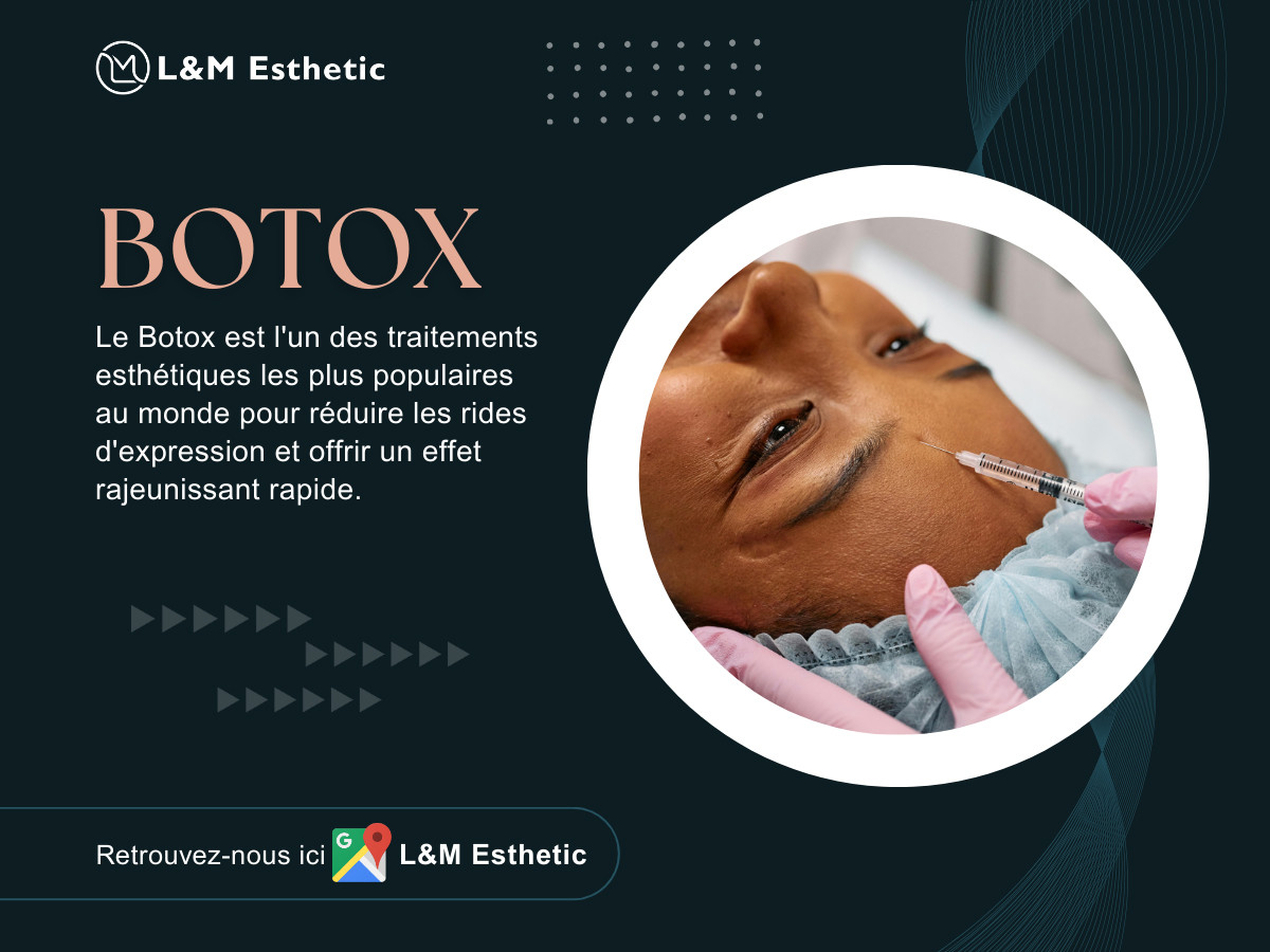 Botox