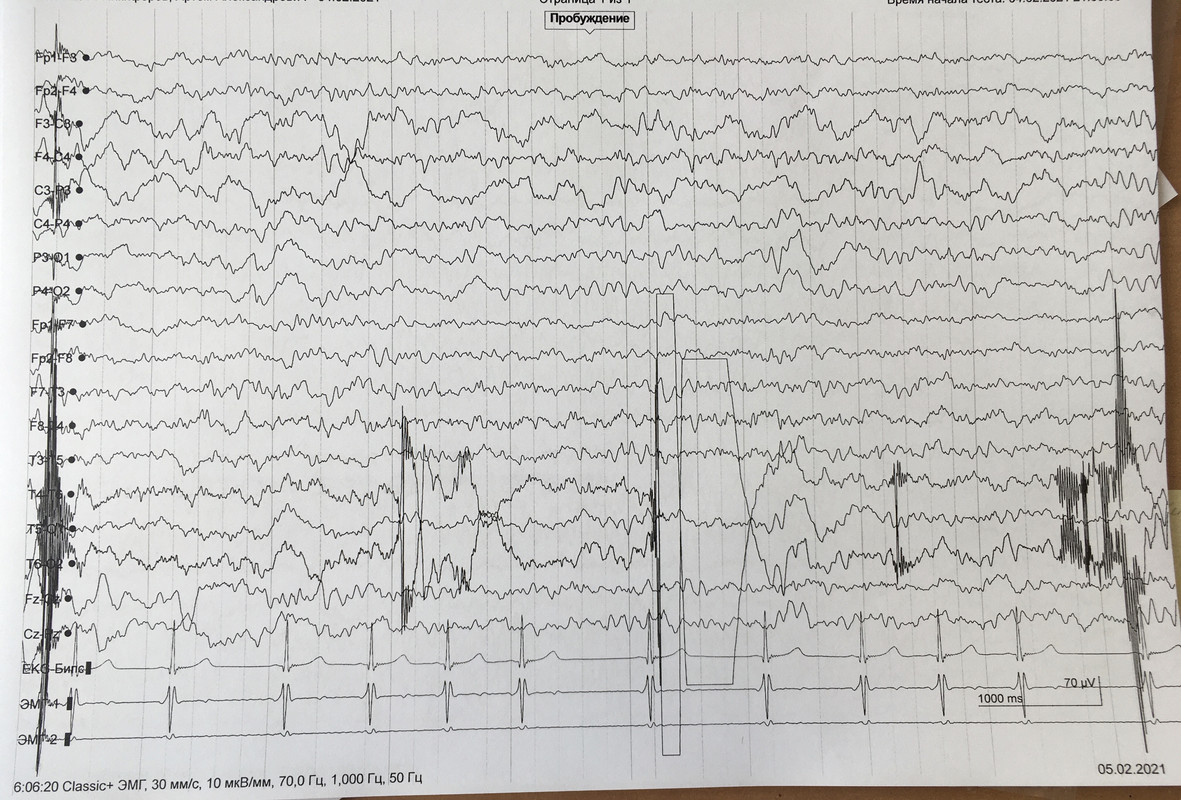 EEC50E2D-F77B-4BF4-B45C-A9B32A350101