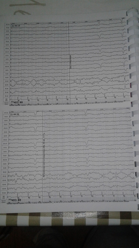 15105223668591534192374