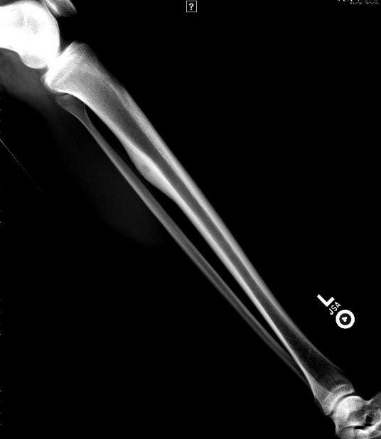 Oncology question 1 image