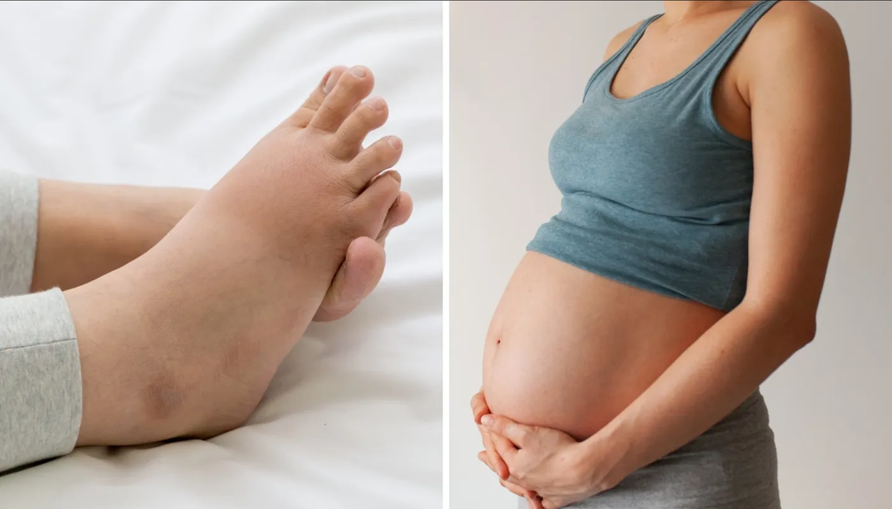 Trucos para aliviar el dolor de pies durante el embarazo