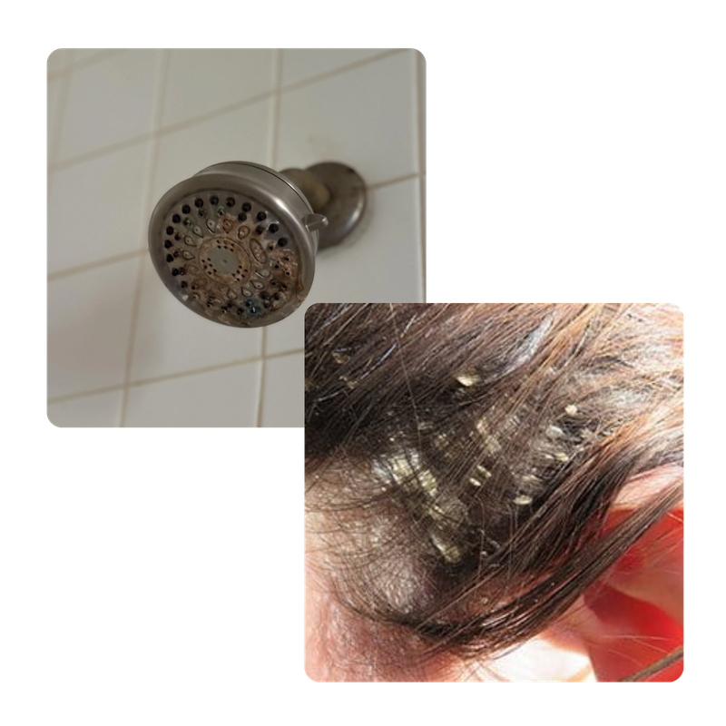 Why filter water - hair and scalp comparison