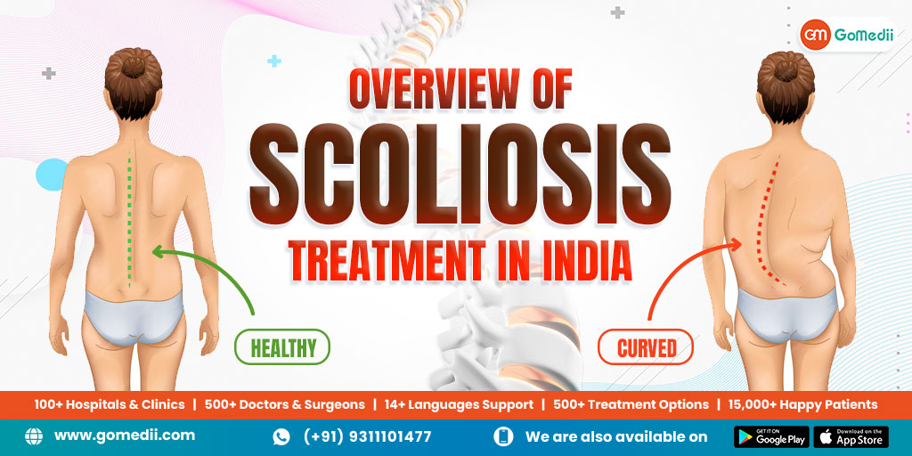 Overview-of-Scoliosis-treatment-in-India-Blog_Sep24_v1