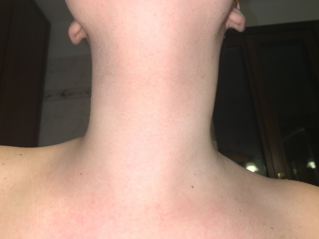 B95502B9-1474-4C87-BAEB-4D47B56D8DA9