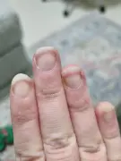 6-years-searching-for-diagnosis-just-found-multiple-v0-dccb9qnhxyod1