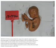 BodyPartsBrokerFetusGraphic