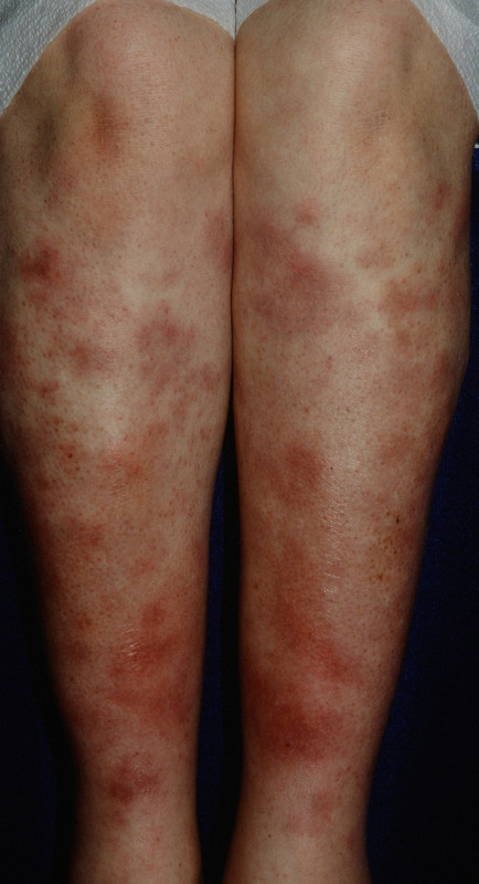 Pulmonology question 4 image