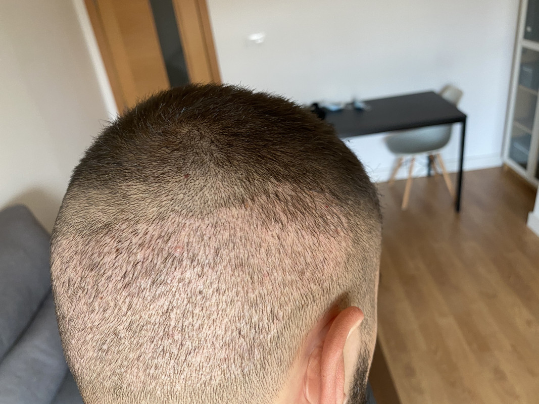 EC93B517-463C-40D6-9E49-88147606AA56