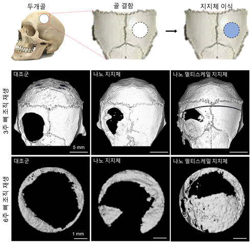 나노 멀티스케일 지지체를 이용하여 재생된 뼈 조직은 대조군들에 비해 뼈 조직 형성이 촉진된다는 것을 확인했다