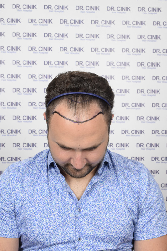 photos préopératoires (7)