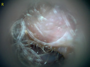 23207 177218 Into CNS 000011