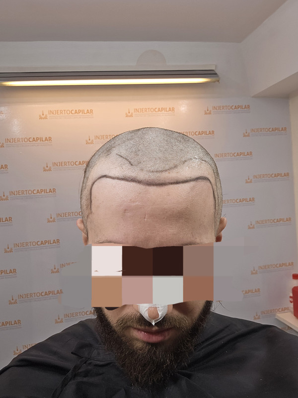 20240812_085224