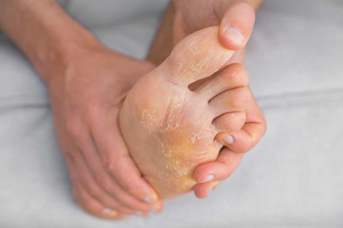 Exfoliación y belleza de pies