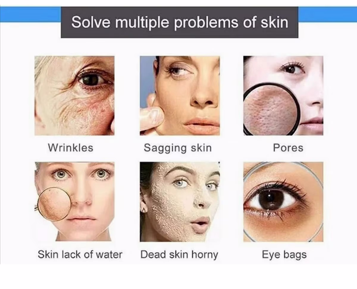 Description of the image