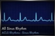 all sinus rhythm