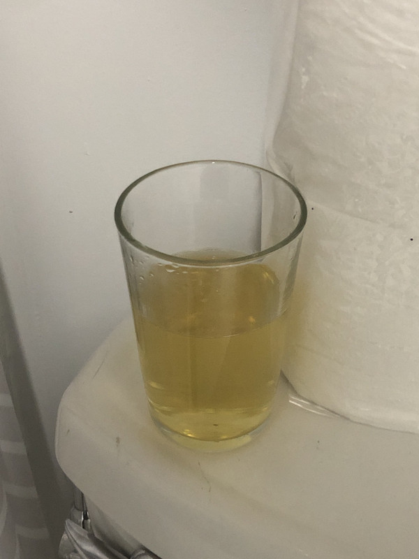 ALBERTO PISS