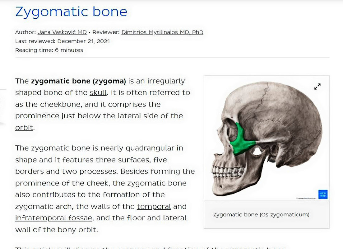 Zygomatic-bone.jpg